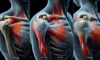 Acupuncture Techniques for Frozen Shoulder Relief